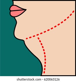 Liposucción de mentón, cuello, cara. Cerrar ilustración vectorial del contorno corporal con línea de puntos. Cirugía plástica. Eliminar el exceso de grasa.