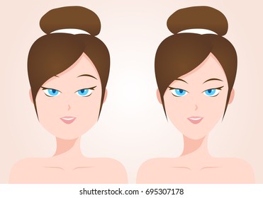 liposuction concept . fat and thin women vector