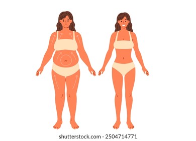 Liposucción para mujeres con sobrepeso posando en ropa interior antes y después de la cirugía. Hermosa chica en necesidad de liposucción demuestra el progreso logrado sin el uso de dietas y fitness