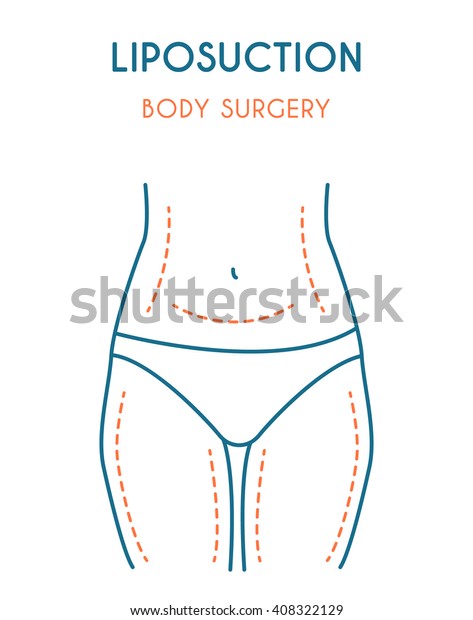 Liposuction Poster Modern Vector Illustration Stock Vector (Royalty ...