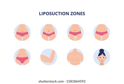 Liposuction zones set - female body parts with drawn lines for plastic surgery and fat removal procedure. Stomach, arms, legs and other areas - flat isolated vector illustration