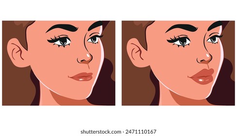 Corrección de labios creando una hermosa línea de sonrisa. Ilustración vectorial.