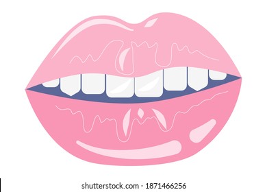 Labios aislados en un fondo blanco. Icono del Día de San Valentín. Los labios rosados separados con dientes. Ilustración vectorial.