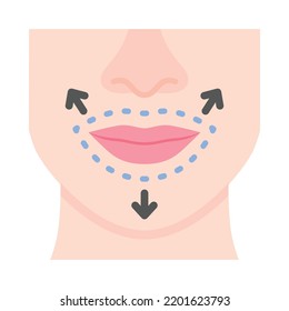 Diseño plano de cirugía de labios.  Cirugía estética en labios con líneas punteadas. Para clínicas de cirugía plástica, publicaciones médicas y de belleza. Ilustración vectorial.