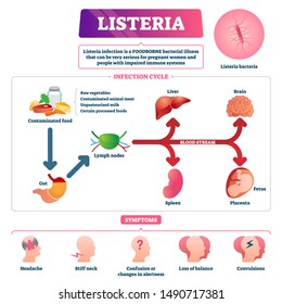 Listeria Vector Illustration. Labeled Educational Foodborne Bacteria Scheme. Infographic Diagram With Infection Cycle, Description And Symptoms List. Food Contamination Caused Illness Explanation.