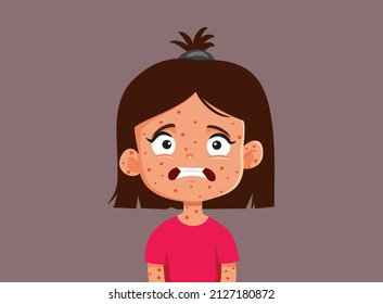 
Little Girl Suffering from Measles Vector Cartoon Illustration. Little kid getting a viral disease suffering from the symptoms
