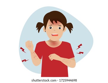 Little Kid Girl Suffering From Red Rash Itchy Skin And Fever From Allergy . Vector Illustration. Idea For Kid Illness, Medical Concept. Isolated On White Background.