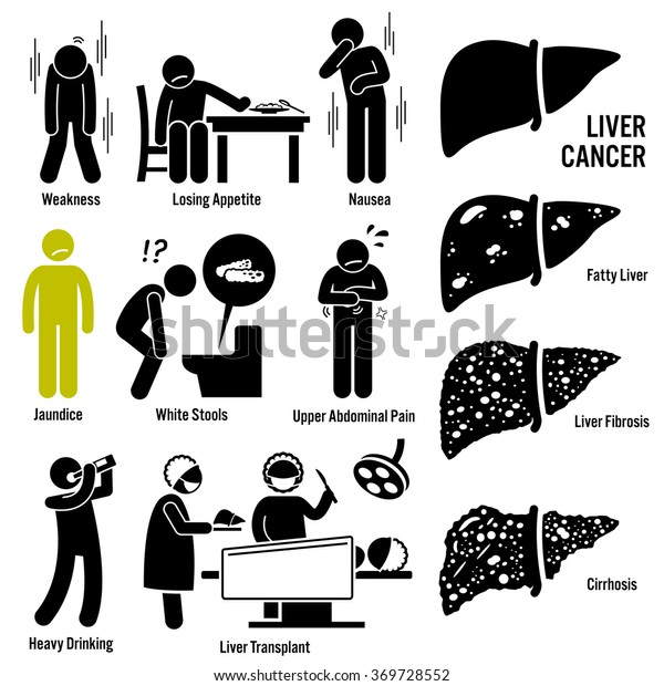 Liver Cancer Symptoms Causes Risk Factors Stock Vector (Royalty Free ...