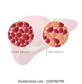 Liver with Liver cell and fat cells - Stock Illustration as EPS 10 File