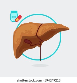 liver cirrhosis vector illustration