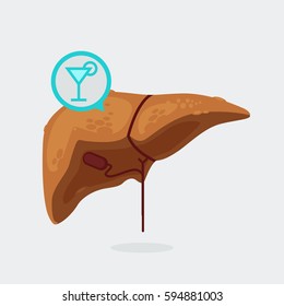 liver cirrhosis vector illustration