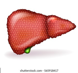 Liver Disease Anatomy Illustration Variety Illnesses Stock Vector ...