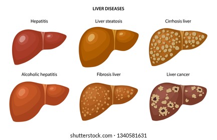 1,902 Liver label Images, Stock Photos & Vectors | Shutterstock