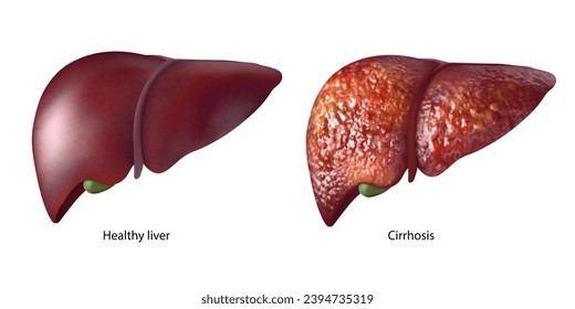 Liver disease. Isolated vector illustration