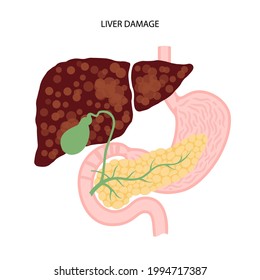 Liver disease logo. Fibrosis, cirrhosis, fatty liver or cancer concept. Pain, tumor or damage in human digestive system concept. Gallbladder, stomach and pancreas anatomical flat vector illustration.