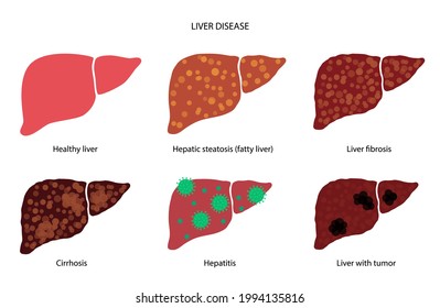 Liver disease svg