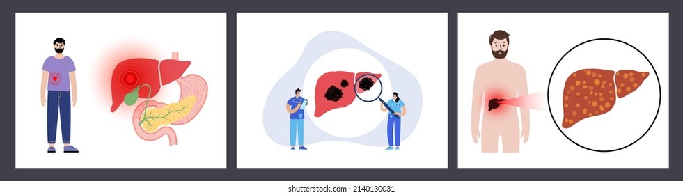 Liver disease logo. Healthy organ, fibrosis, cirrhosis or fatty liver concept. Pain, tumor or hepatitis in human digestive system concept. internal organs anatomical poster flat vector illustration