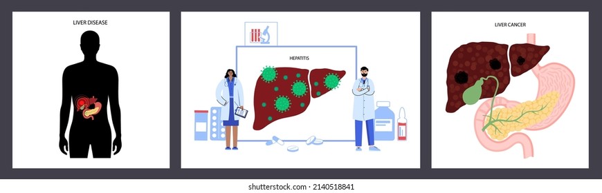 Logo de la enfermedad hepática. Órgano sano, fibrosis, cirrosis o concepto de hígado graso. Dolor, tumor o hepatitis en el concepto del sistema digestivo humano. órganos internos carteles anatómicos ilustración vectorial plana