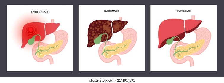 Liver disease logo. Healthy organ, fibrosis, cirrhosis or fatty liver concept. Pain, tumor or hepatitis in human digestive system concept. internal organs anatomical poster flat vector illustration