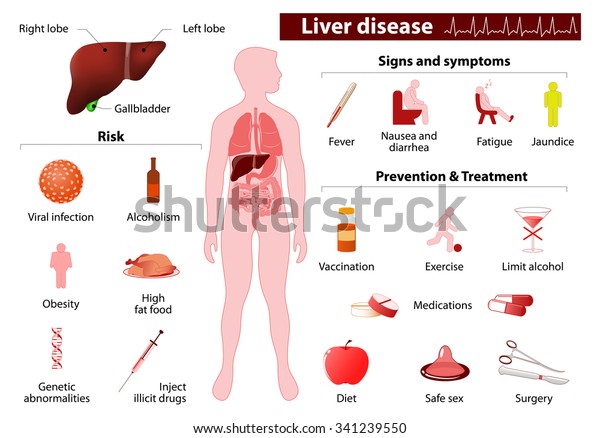 Liver Disease Medical Infographic Set Elements Stock Vector Royalty