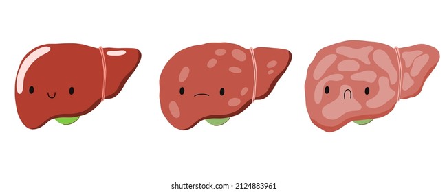  Liver disease. Sick and healthy liver character. Cirrhosis, hepatitis, fatty liver. Stock vector cartoon illustration on a white background.