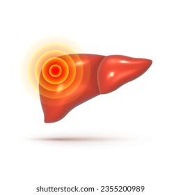 Liver disease. Sick painful liver 3d vector illustration. Realistic human organ on white background.