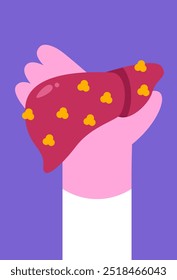 Liver full of fat in human hand. Fatty disease of the liver organ or Hepatosteatosis. Increased fat deposition in the liver. Warning about problematic organs. Flat vector illustration.