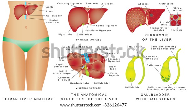 Liver and Gallbladder. Cirrhosis. Major\
anatomical landmarks and four lobes of liver. Anatomical structure\
of liver, gallbladder and bile ducts. Interior of gallbladder.\
Gallbladder with\
gallstones