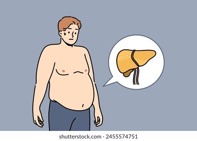 Liver illnesses in men cause obesity and digestive problems and symptoms of fatty hepatosis. Yellow liver near guy suffering from jaundice caused by poor hygiene or weakened immune system