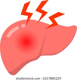 Ilustración vectorial aislada de mal funcionamiento hepático.