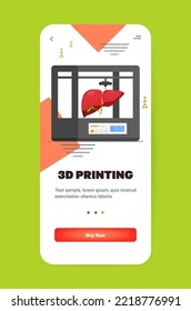Abdrücke von Lebermodellen auf 3D-Biodruckern, medizinischer Ausdruck von bioprinierendem Bioprint für die Organtransplantation