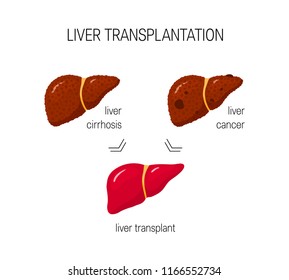 Liver transplantation concept in cartoon style
