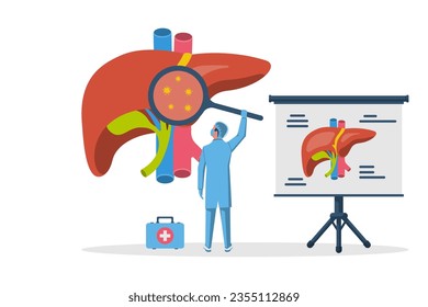 Tratamiento hepático. Los médicos estudian los órganos internos del hígado y la vesícula biliar, el conducto hepático. Estructura del órgano interno. Diseño plano de ilustración vectorial. Aislado sobre fondo blanco.