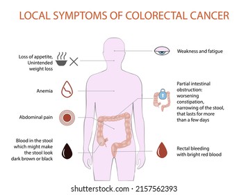 Local Symptoms Of Colorectal Carcinoma, Vector, Medical Diagram