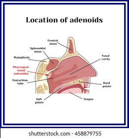 Location of adenoids.The structure of the nasopharynx. 