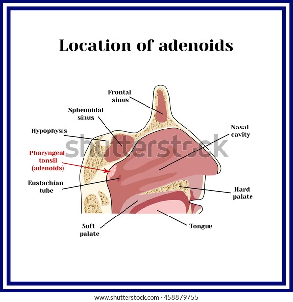 Location Adenoids Structure Nasopharynx Stock Vector (Royalty Free ...