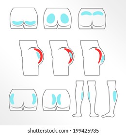 Location buttocks and calf implants / Solid fill and outline icons