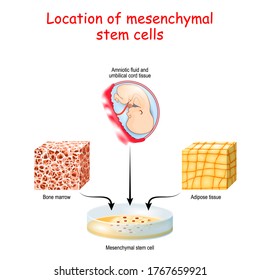 Location of mesenchymal stem cells. Bone marrow, Adipose tissue, Amniotic fluid and umbilical cord tissue. Vector illustration