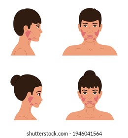 The location of the parotid, submandibular and sublingual salivary glands in the male and female body. Flat vector illustration of healthy salivary glands