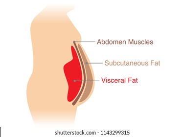 Location of Visceral fat stored within the abdominal cavity. Illustration about medical diagram.
