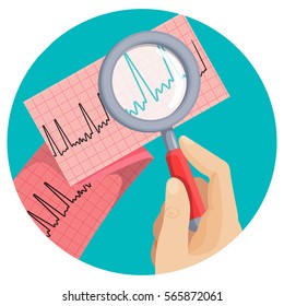 Look on atrial fibrillation through magnifying glass that human hand holds in round vector picture on white. Long piece of paper with ECG scheme of improper heart working, emergency cardiology.