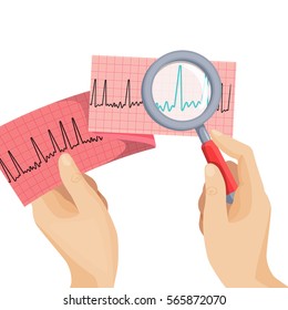 Look on atrial fibrillation through magnifying glass that human hand holds in round vector picture on white. Long piece of paper with ECG scheme of improper heart working, emergency cardiology.