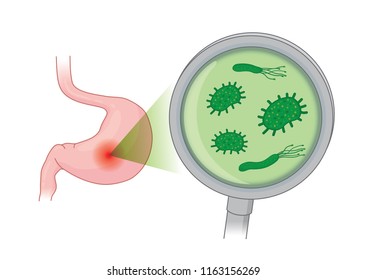 Looking Bacterial in human stomach with with Magnifying glass. Concept illustration about health care and medical.