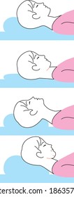 Loose chin and neck due to high pillow