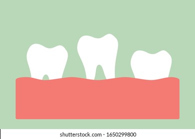 loose tooth, tooth is fall out of the gum - dental cartoon vector flat style cute character for design