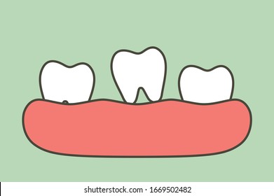 loose tooth, tooth is fall out of the gum - dental cartoon vector flat style cute character for design