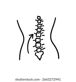Arco lumbar de Lordosis con curvatura espinal
