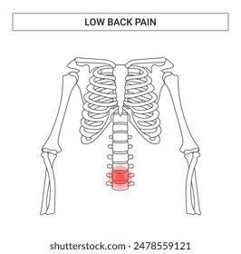 Diseño médico del dolor lumbar con estilo de la línea