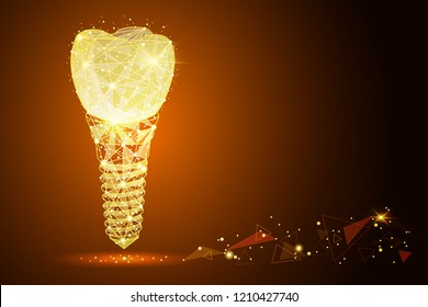 Low poly illustration of the dental implant a golden dust effect. Polygonal wireframe from dots and lines.