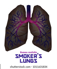 Low poly realistic human lungs and bronchus with cancer inflammation disease. Smoker's lungs. Vector.